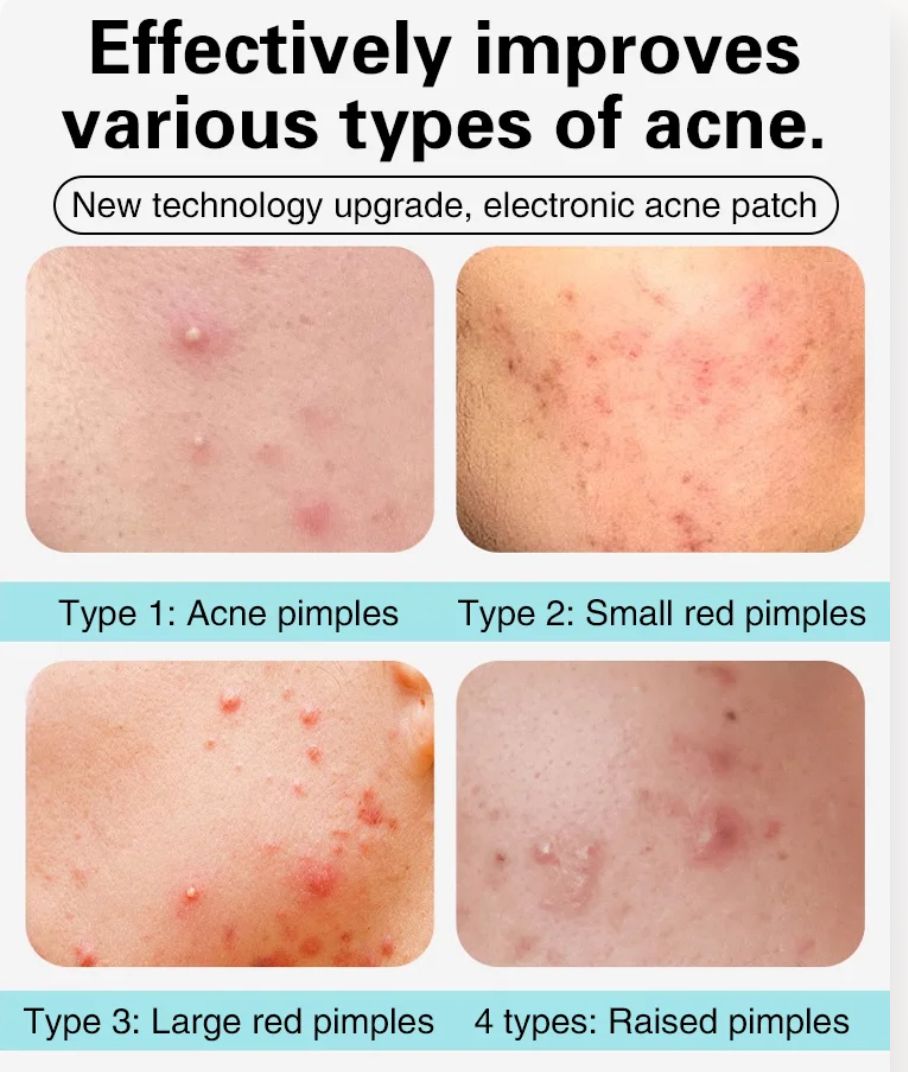 LED Light Therapy Acne Patches