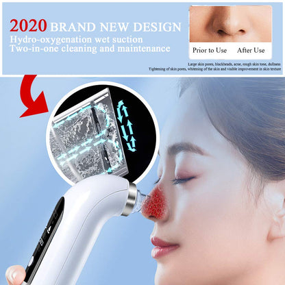 ClearSkin™ Pore Vacuum Blackhead Remover